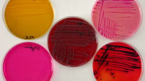 Salmonellen auf verschiedenen Nährmedien