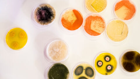 Kultur von Bakterien in einer Petrischale Unterschiedlich farbige Bakterienkolonien in Petrischalen