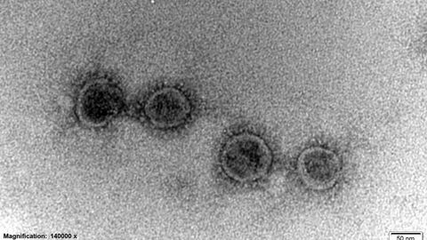Coronavirusinfektionen bei Tieren Mikroskopische Abbildung von Corona-Viren