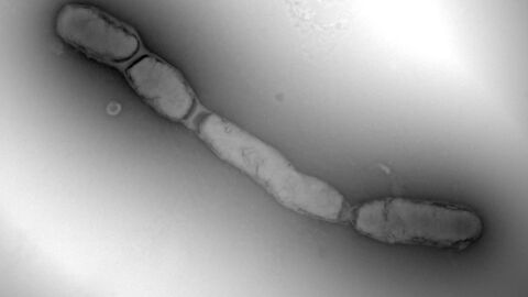 Transmissionselektronenmikroskopische Aufnahme des Rattenbissfieber-Erregers Streptobacillus moniliformis 