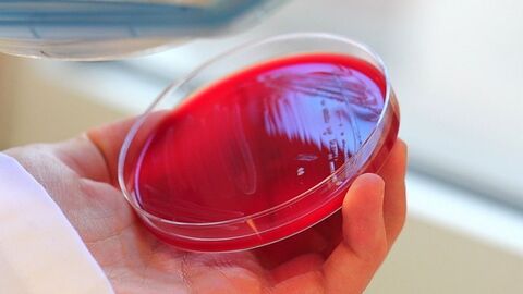 Eutergesundheit Petrischale, die von einer Hand gehalten wird