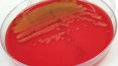 Bakterienkultur von S. catagoni mit deutlich erkennbarer ß-Hämolyse