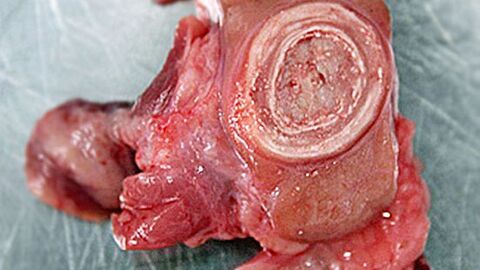 Lymphknoten eines mit einer Corynebacterium silvaticum-Infektion betroffenen Wildschweins mit zwiebelschalenartigen Veränderungen