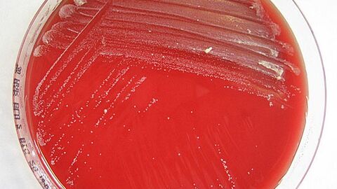 Corynebacterium silvaticum auf Schafblutagar