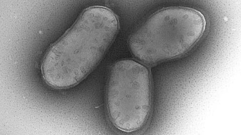 Elektronenmikroskopische Aufnahme von Corynebacterium silvaticum