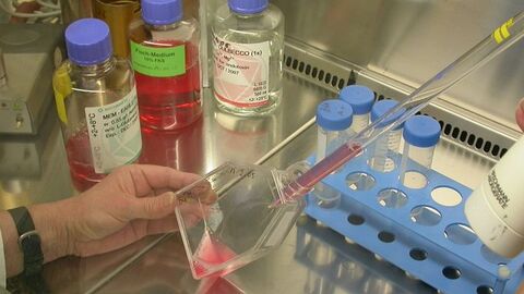 Eine Hand hält einen Glasbehälter während die andere Hand mit einer Pipette Flüssigkeit abzieht