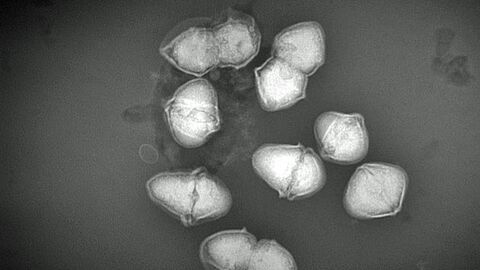 Elektronenmikroskopische Abbildung des neu beschriebenen Bakteriums Streptococcus catagoni 