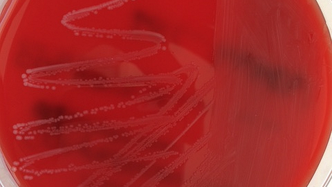 Petrischale mit rotem Nährboden zeigt einen Belag mit Erregern