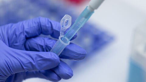 Pipettieren in ein Mikroreaktionsgefäß Person mit blauen Handschuhen pipetiert in ein Mikroreaktionsgefäß