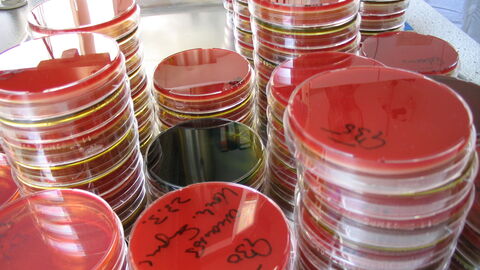 Aufeinandergestapelte Untersuchungsgläser, Petrischalen