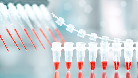 DNA-Amplifikationstest und Reaktionsmischung in automatischer Mehrkanalpipette.