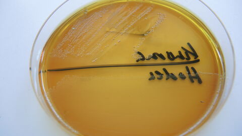 Salmonellennachweis aus Organen eines Wildschweins Petrischale mit Salmonellennachweis aus Organen eines Wildschweins