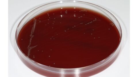 Blutagarplatte Erysipelothrix anatis 