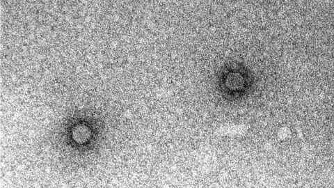 West Nil Virus auch im Jahr 2022 wieder in Deutschland nachgewiesen! Elektronenmikroskop-Bild West-Nil-Virus