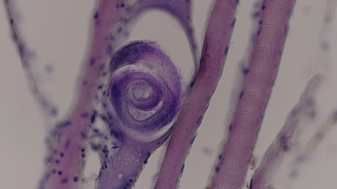Eine Trichinella-Larve aufgerollt in einer Muskelzelle