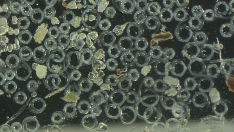 Trichinella-Larven in Digestionsflüssigkeit