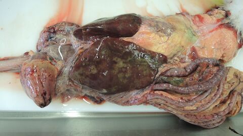 Organe des gleichen Tieres aus Abbildung 3a mit Einblutungen in Herzmuskel und Fettgewebe im Darmbereich, multiple Nekrosen im Leberbereich, hochgradige Verklebungen zwischen den Organen.