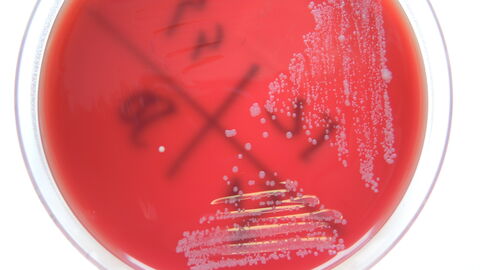 Prototheken auf Rinderblut-Äskulin-Agar