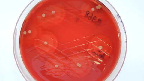 Staphylococcus aureus aus einer Tankmilchprobe auf Rinderblut-Äskulin-Agar 