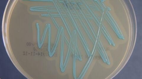 Nachweis von Listeria monocytogenes aus Tankmilchprobe (Aloa-Spezialagar)