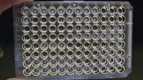 Mikrobouillondilutionstest mit Wachstum von Bakterien zur Antibiotikaempfindlichkeits-prüfung 