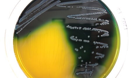 Abb. 9: Escherichia coli auf Gassner-Agar