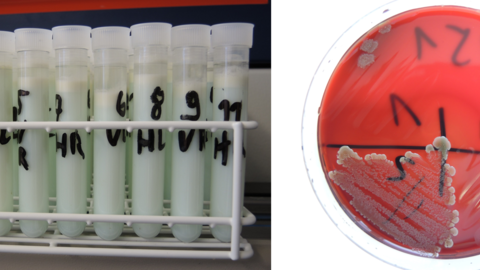 Milchprobenröhrchen nach Registrierung im Labor und kulturelles Wachstum von Mastitiserregern nach Inkubation im Brutschrank
