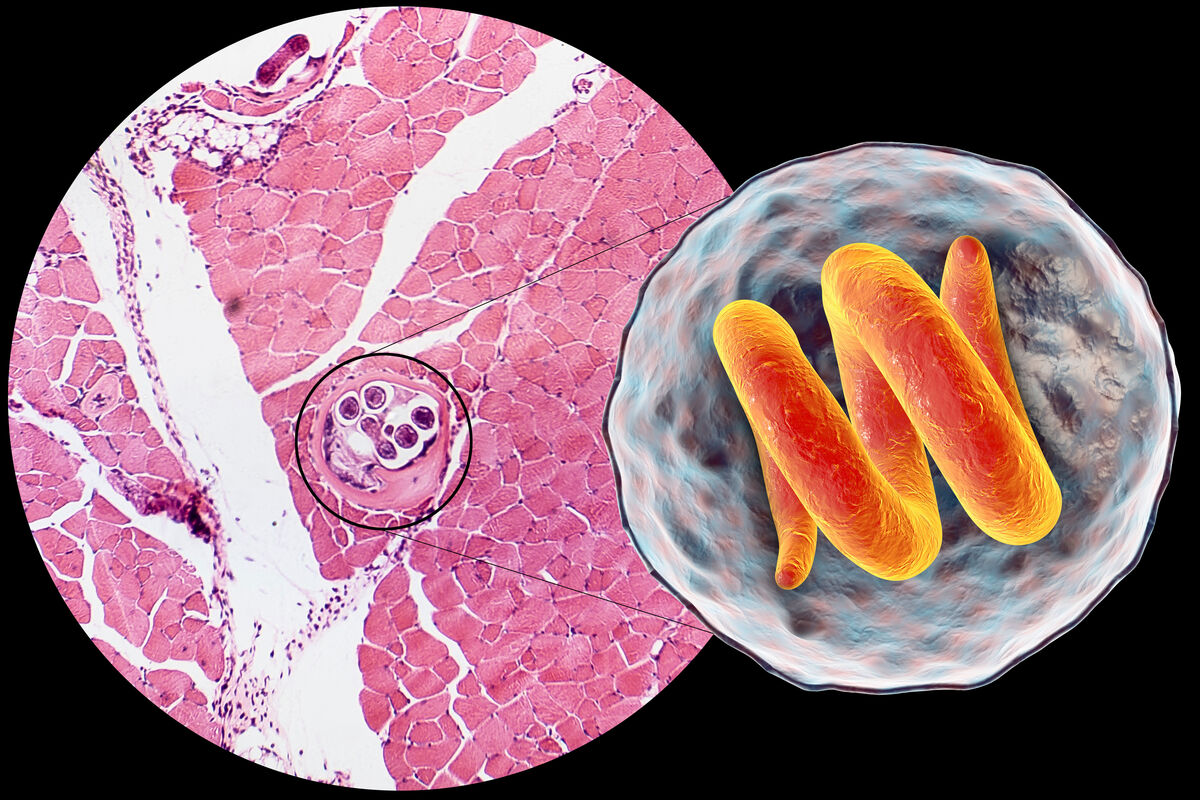 Trichinenuntersuchungen | Hessisches Landeslabor
