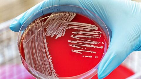 Corynebacterium ulcerans auf Schafblutagar mit Kreidestrich-artigem Wachstum des Impfstriches