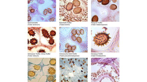 Neun einzelne Darstellungen von Sporen unterschiedlicher Trüffelarten unter dem Mikroskop