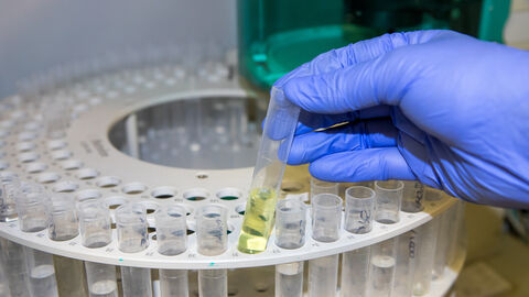 Ionenchromatographie