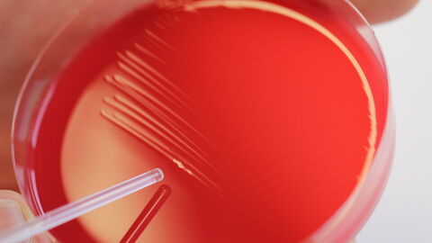 Mit einem Stäbchen wird in einer Petrischale eine Kultur aufgebracht