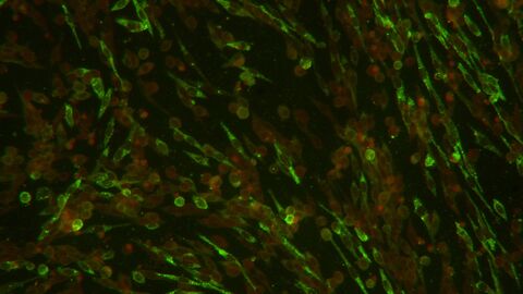 Bild einer Immunfluoreszenz Aufnahme