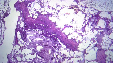 Ahle Leberwurst Epithelgewebe