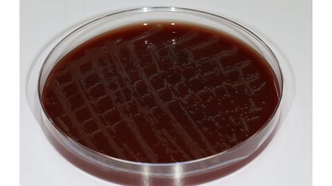 Blutagarplatte mit Erysipelothrix aquatica