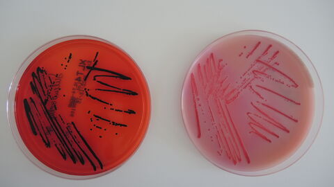 Salmonellen auf Agarplatten angezüchtet