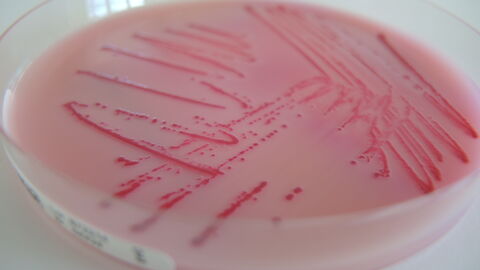 Anzucht von Salmonellen auf einer Agarplatte