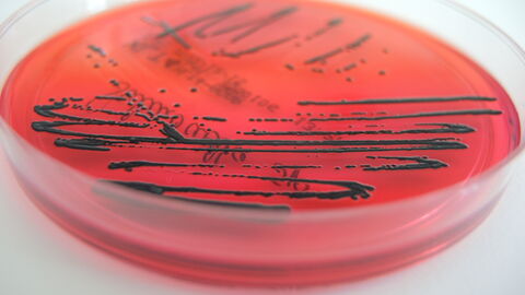 Anzucht von bestimmten Salmonellenarten auf einer Agarplatte