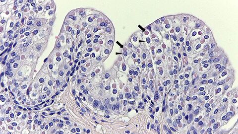 Eosinophile intrazytoplasmatische Einschlusskörperchen im Übergangsepithel der Harnblase eines Fuchses
