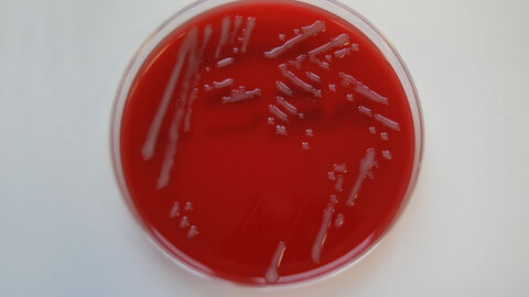 Nachweis von Pasteurella multocida auf einem Schafblut-Agar durch graue, schleimige Kolonien ohne Hämolyse