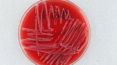 Kolonien von Corynebacterium ulcerans auf Schafblutagar
