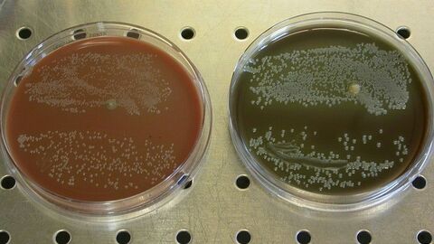 Reinkultur des Tularämie-Erregers (Francisella tularensis) in Petrischalen