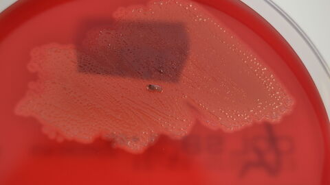 Sutonella ornithocola auf Columbia-Schafblutagar