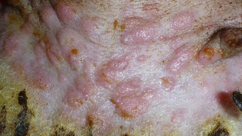 Schafpocken, Hautknoten bei einem Schaf